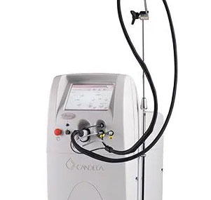 Vbeam II 赤アザ治療レーザー